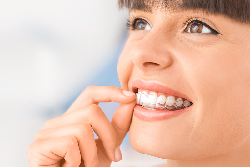 Invisalign in Baytown