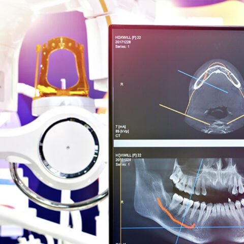 digital xrays