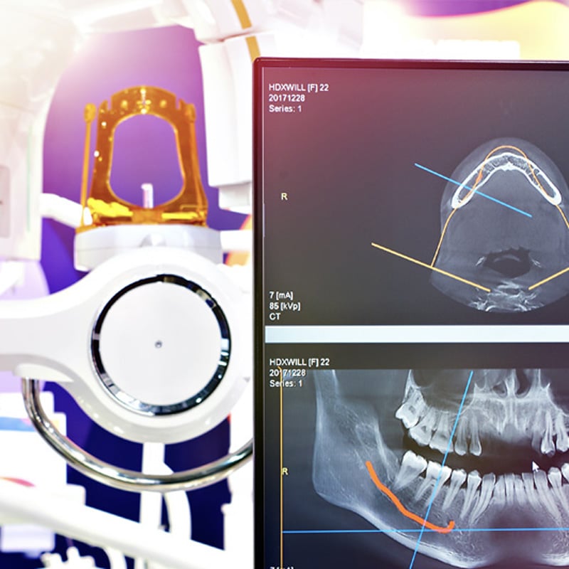 digital-xrays