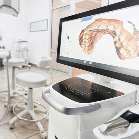 3D model of teeth